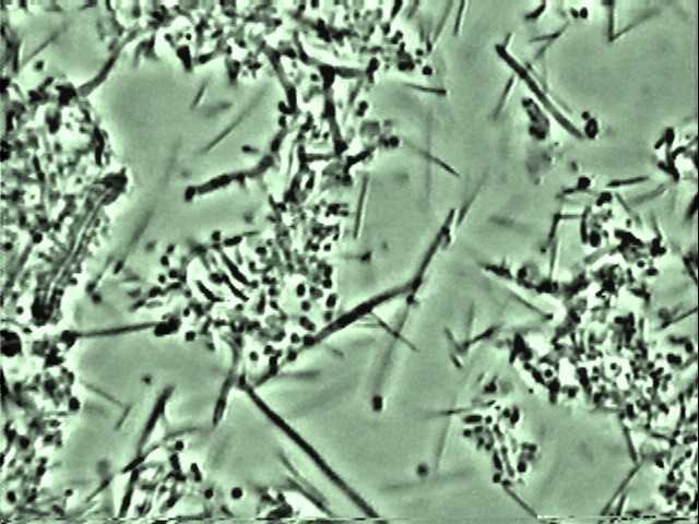 Observation au microscope d’une flore bactérienne saine : coques, filaments et bâtonnets immobiles
